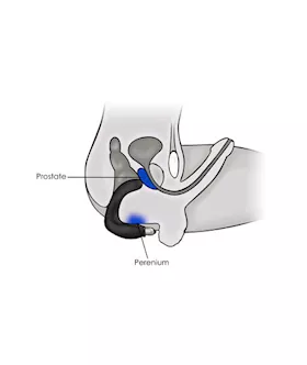 Rude Boy P-spot Vibrator