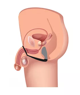 Explorer Ii Prostate Stimulator And Cock Ring