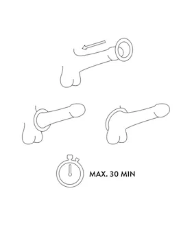 Miss V Rocky Cock Ring