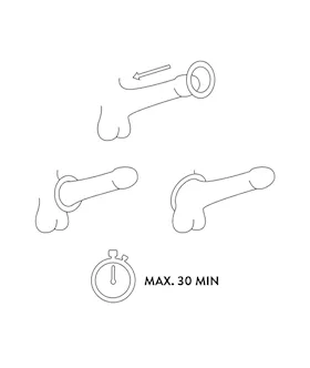 Moqqa Tide Penis Ring