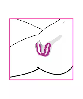 Petal Pusher Silicone Labia Spreader