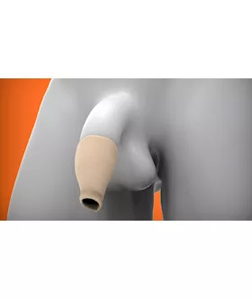 Hood Moreskin Foreskin - Large